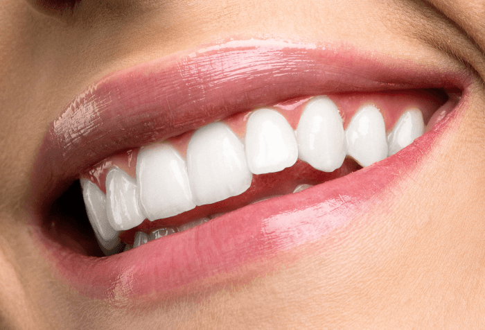 What’s in Your Aesthetic Dentistry Toolkit?